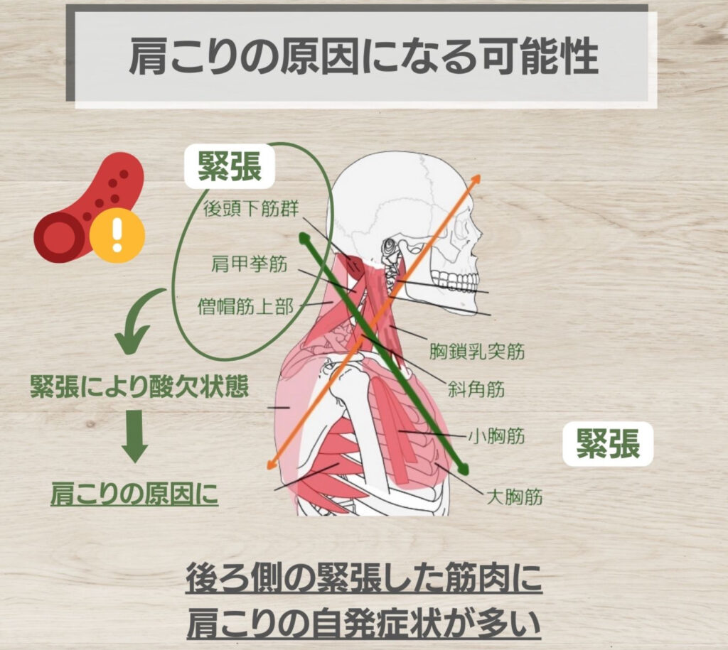 肩こりの原因になる可能性