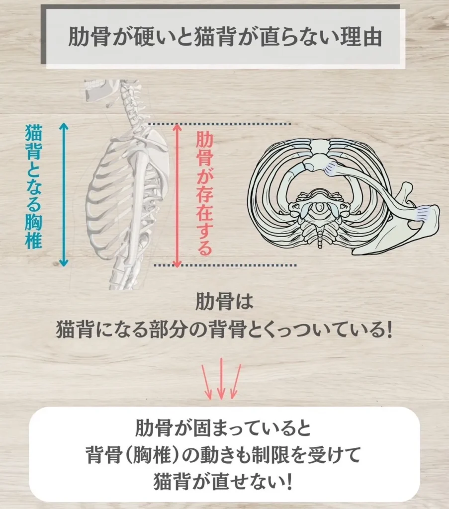 肋骨が硬いと猫背が直らない理由