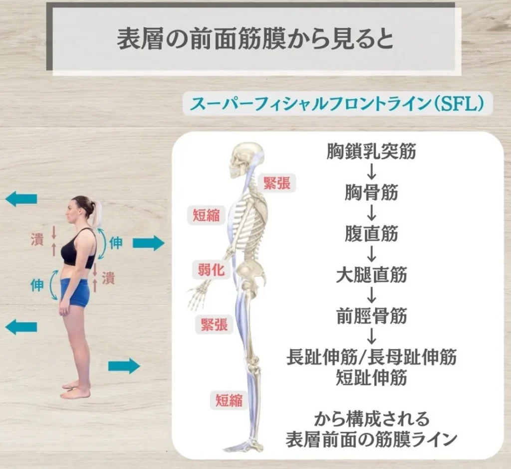 前側の筋膜SFLから姿勢を見ると