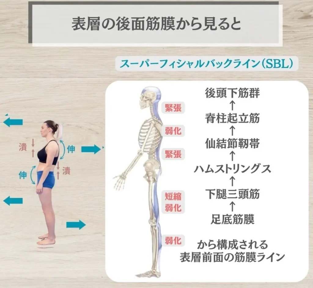 後ろ側の筋膜SBLから姿勢を見ると