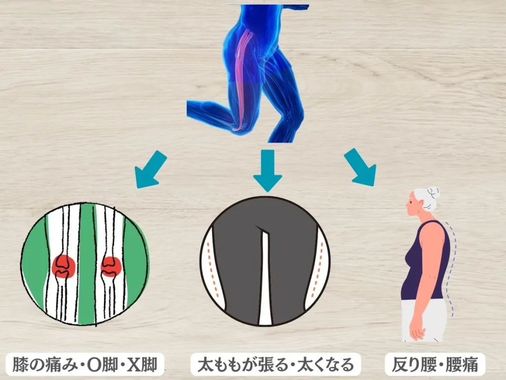 大腿筋膜張筋が固くなると身体の歪みや痛みなどの悪影響が