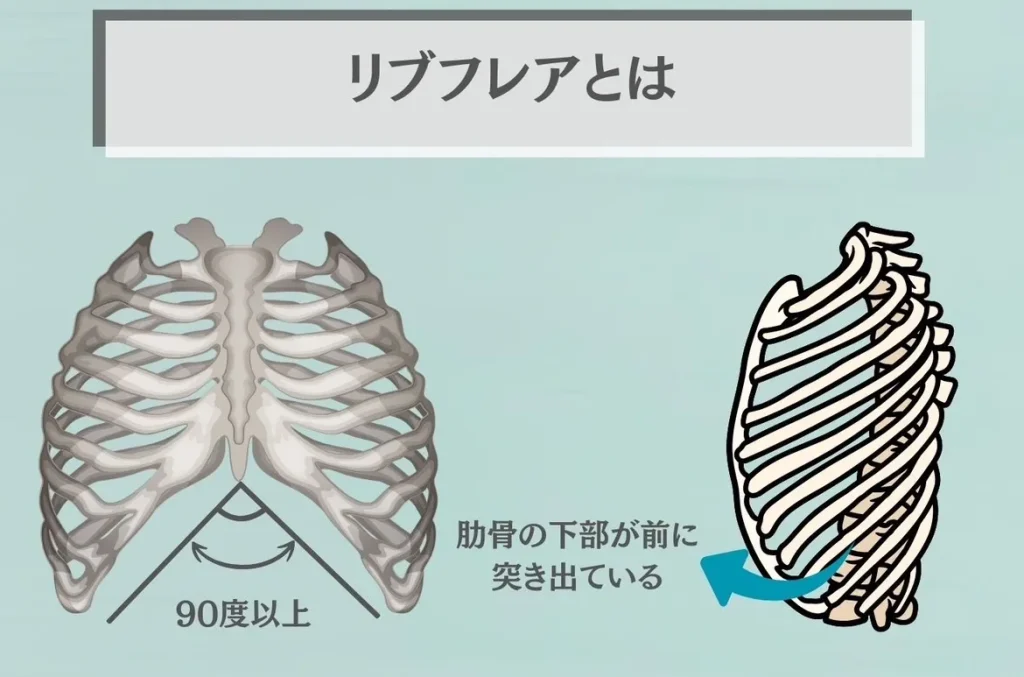 リブフレアとは