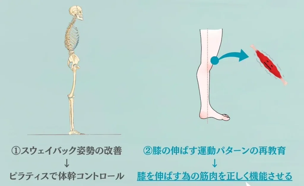 反張膝の改善方法