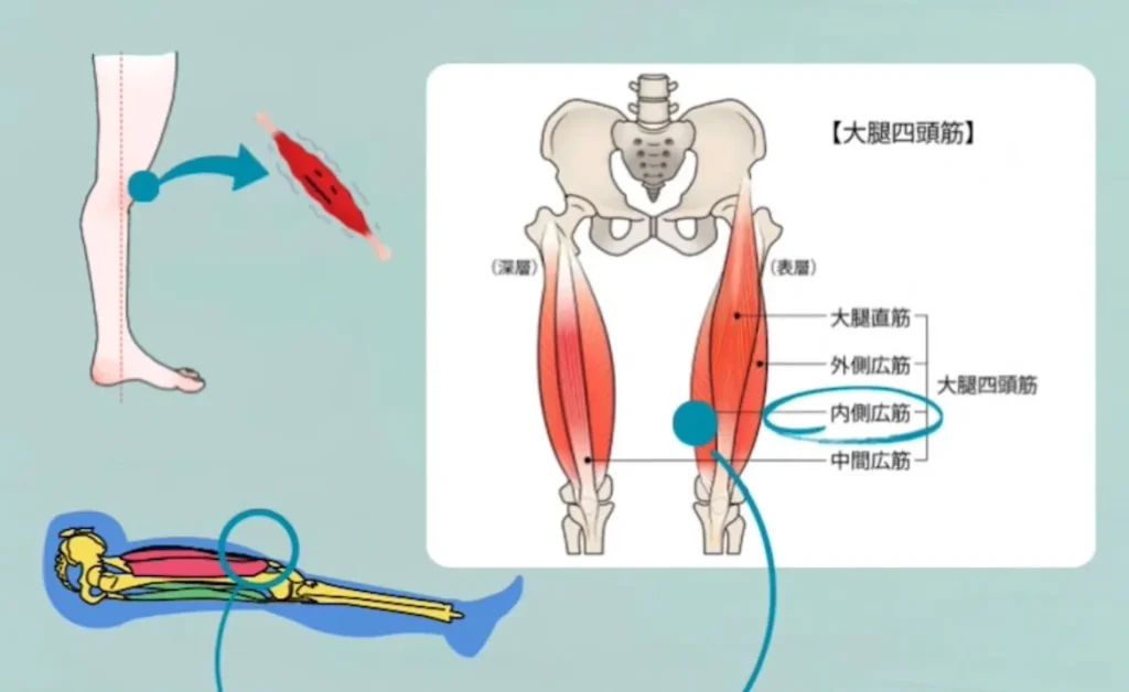 膝を伸ばす筋肉