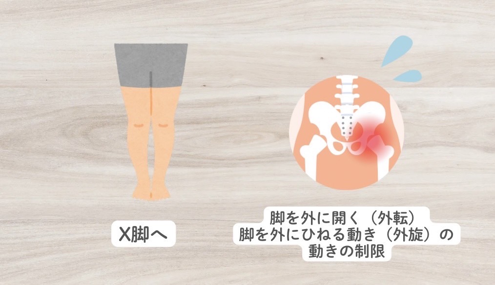 内転筋が固くなると