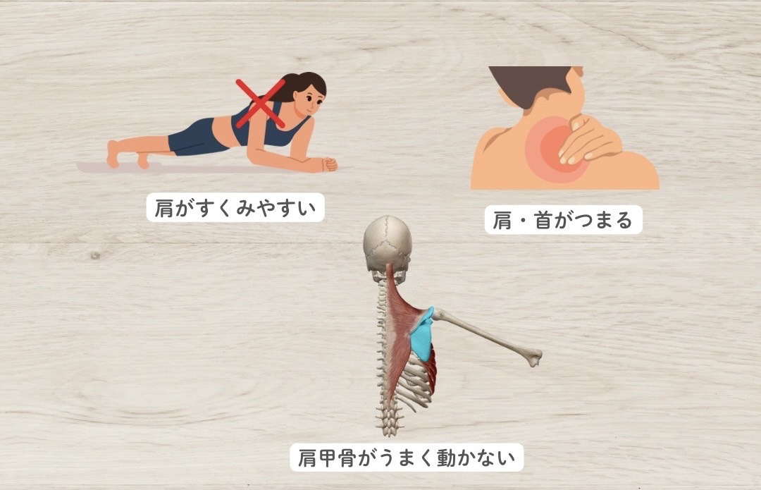 前鋸筋不全の代償動作