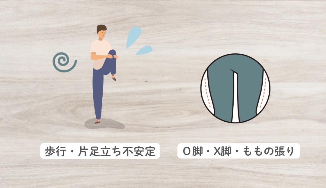 内転筋が弱くなると