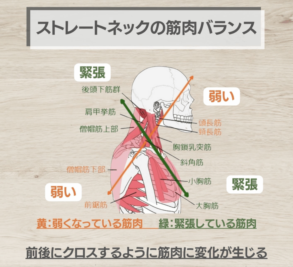 上位交差症候群