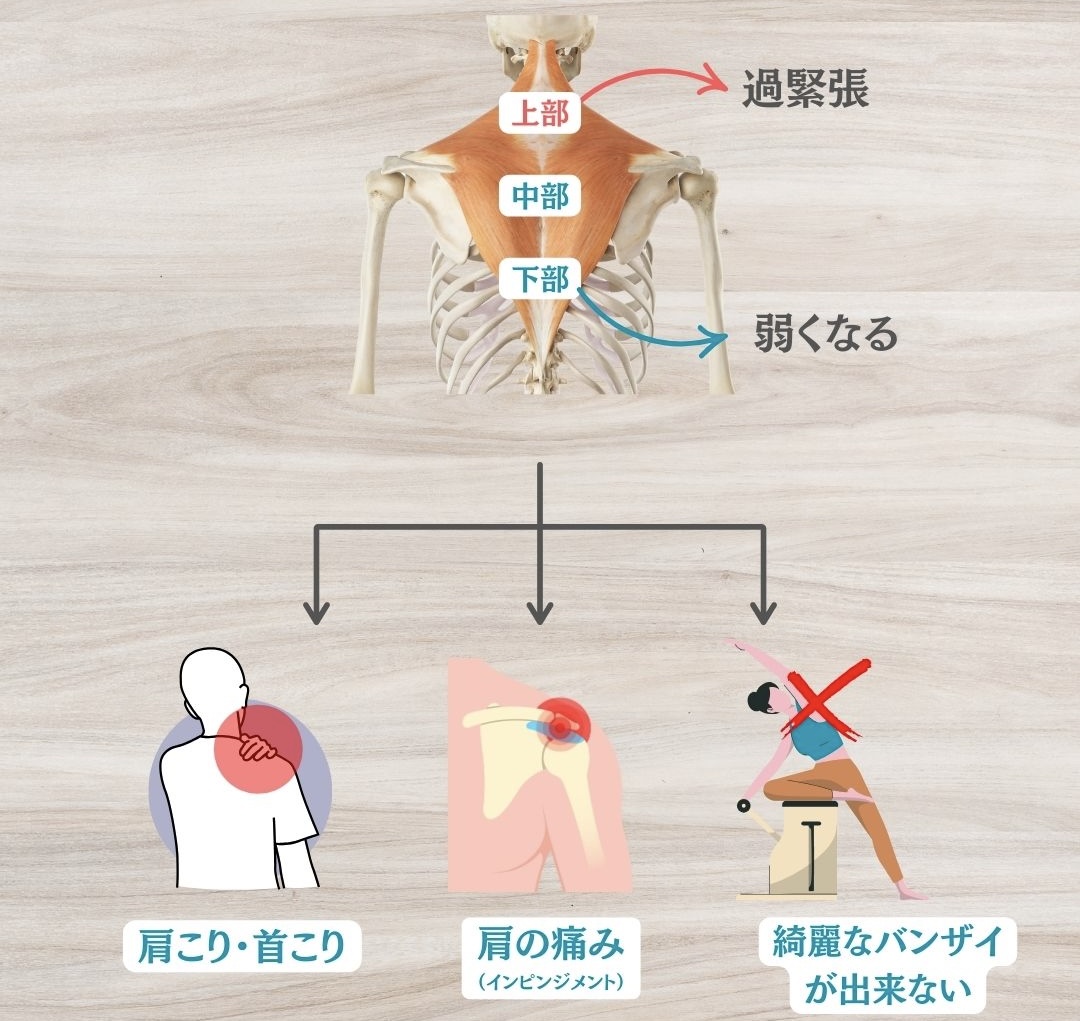 僧帽筋のエラー