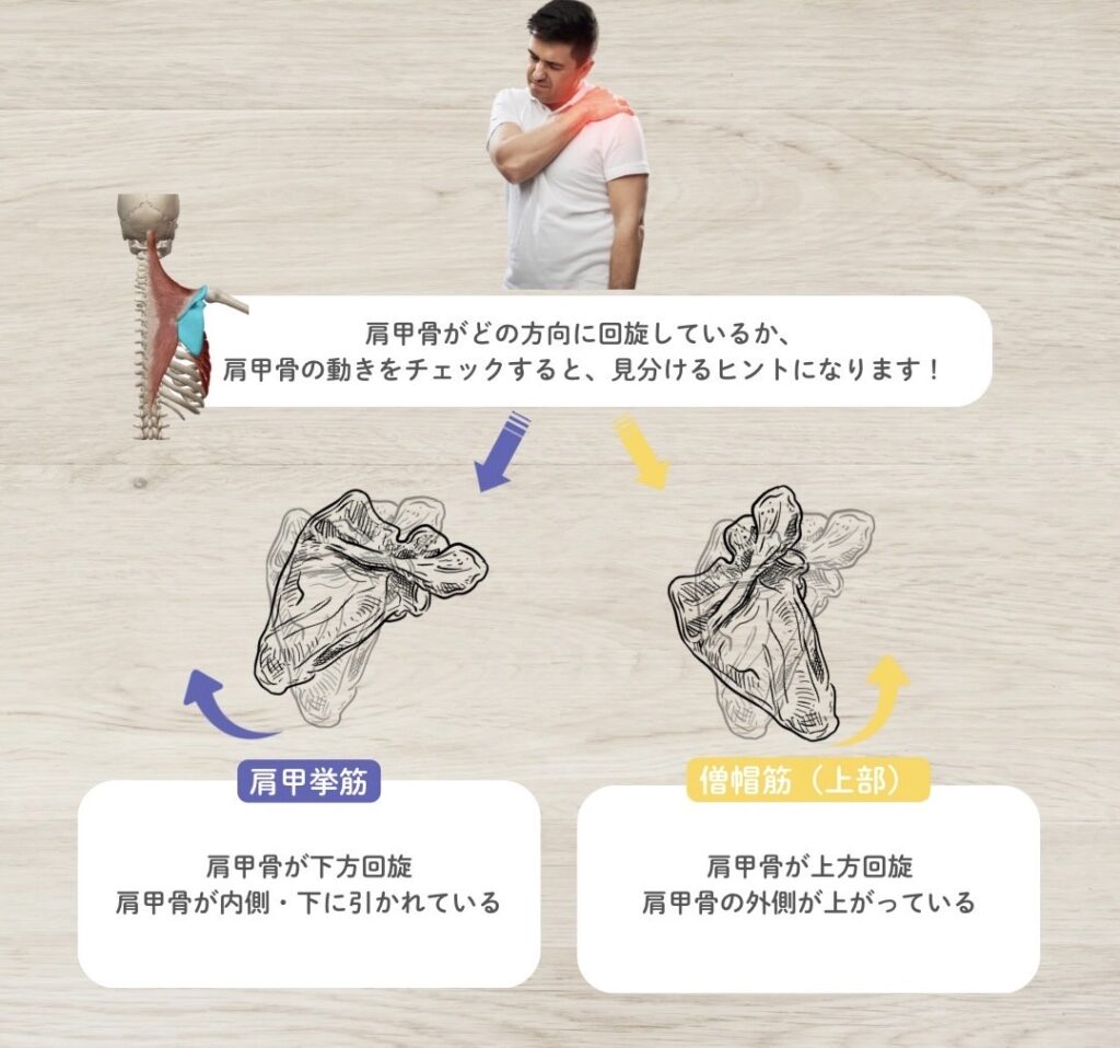 肩こりの原因は、肩甲挙筋?それとも僧帽筋?