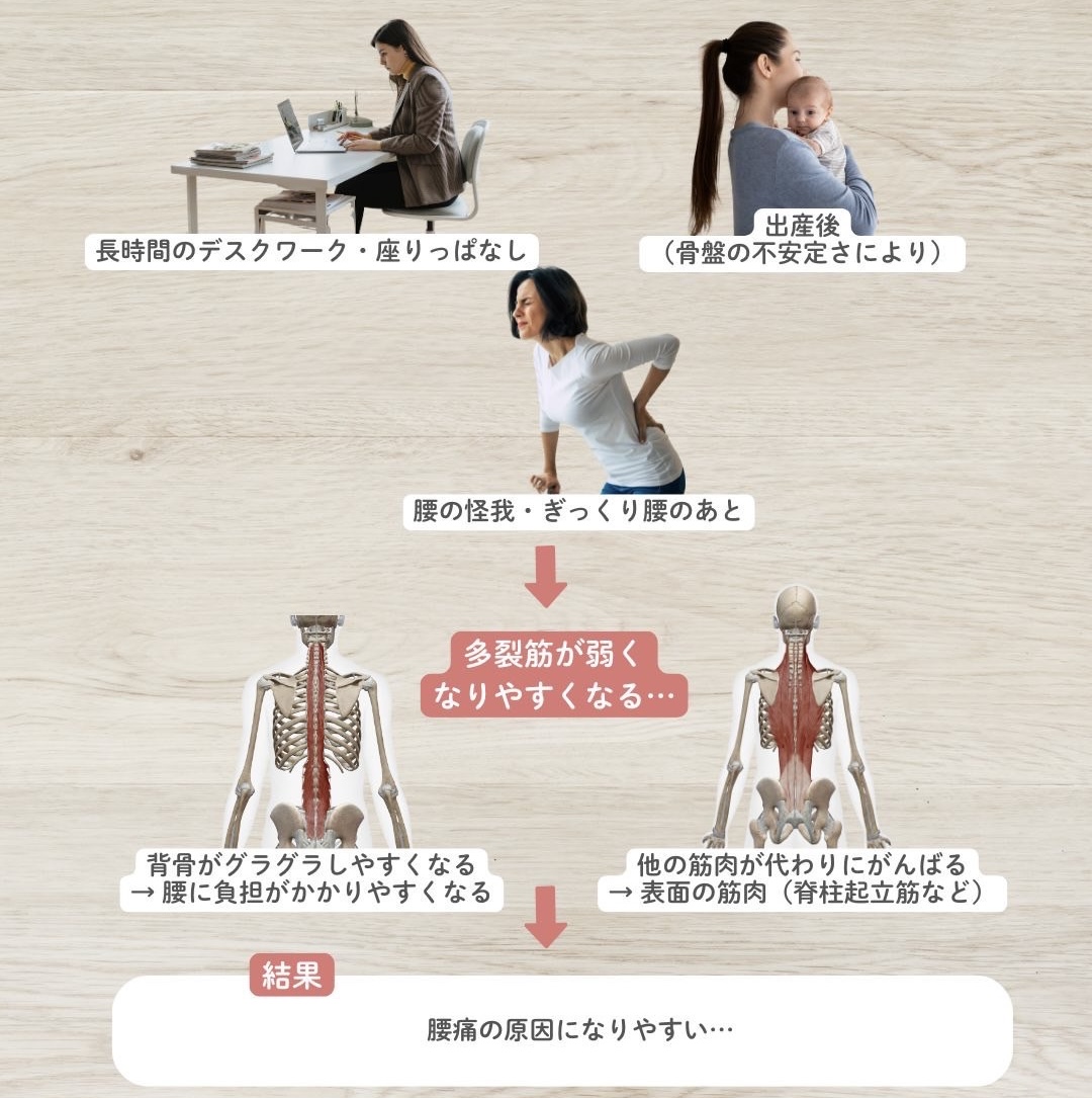 多裂筋と腰痛の関係