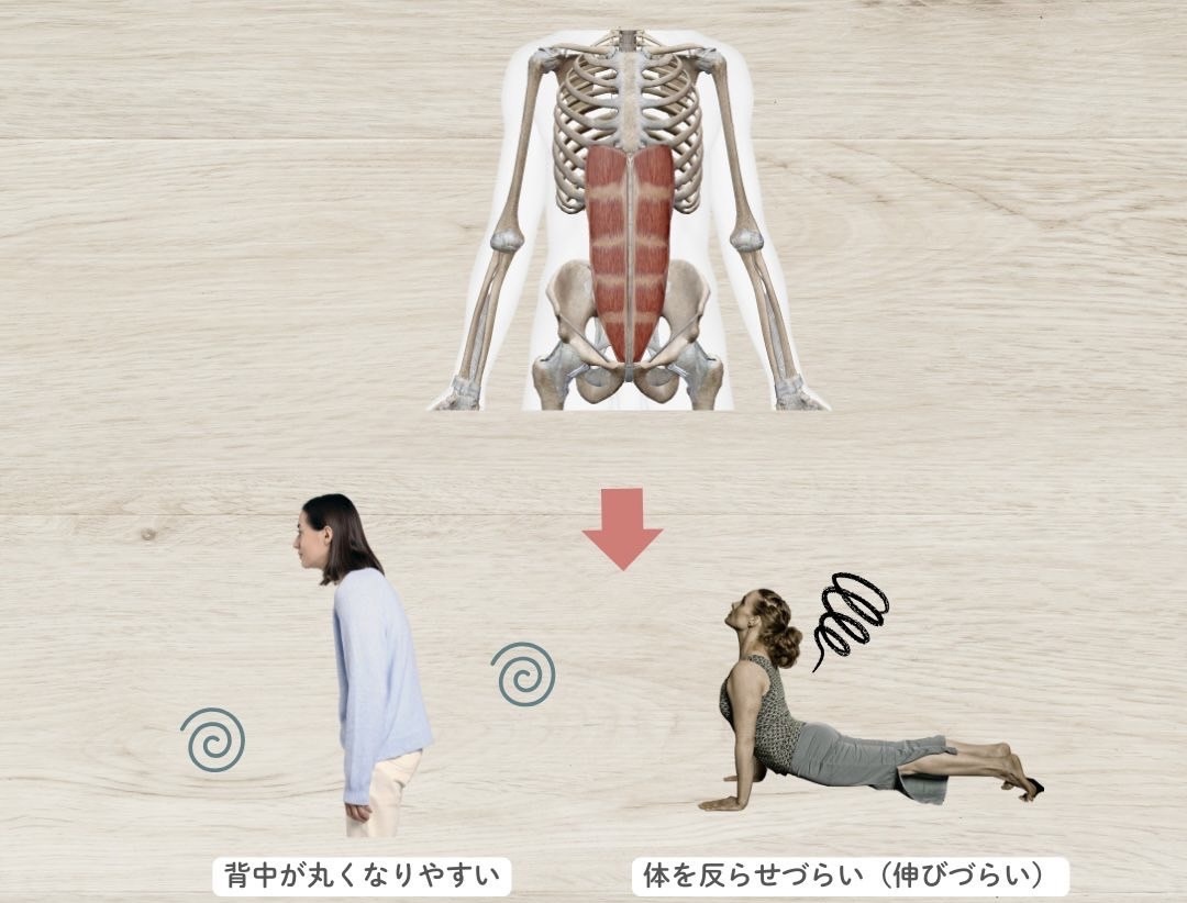 腹直筋と姿勢のエラー