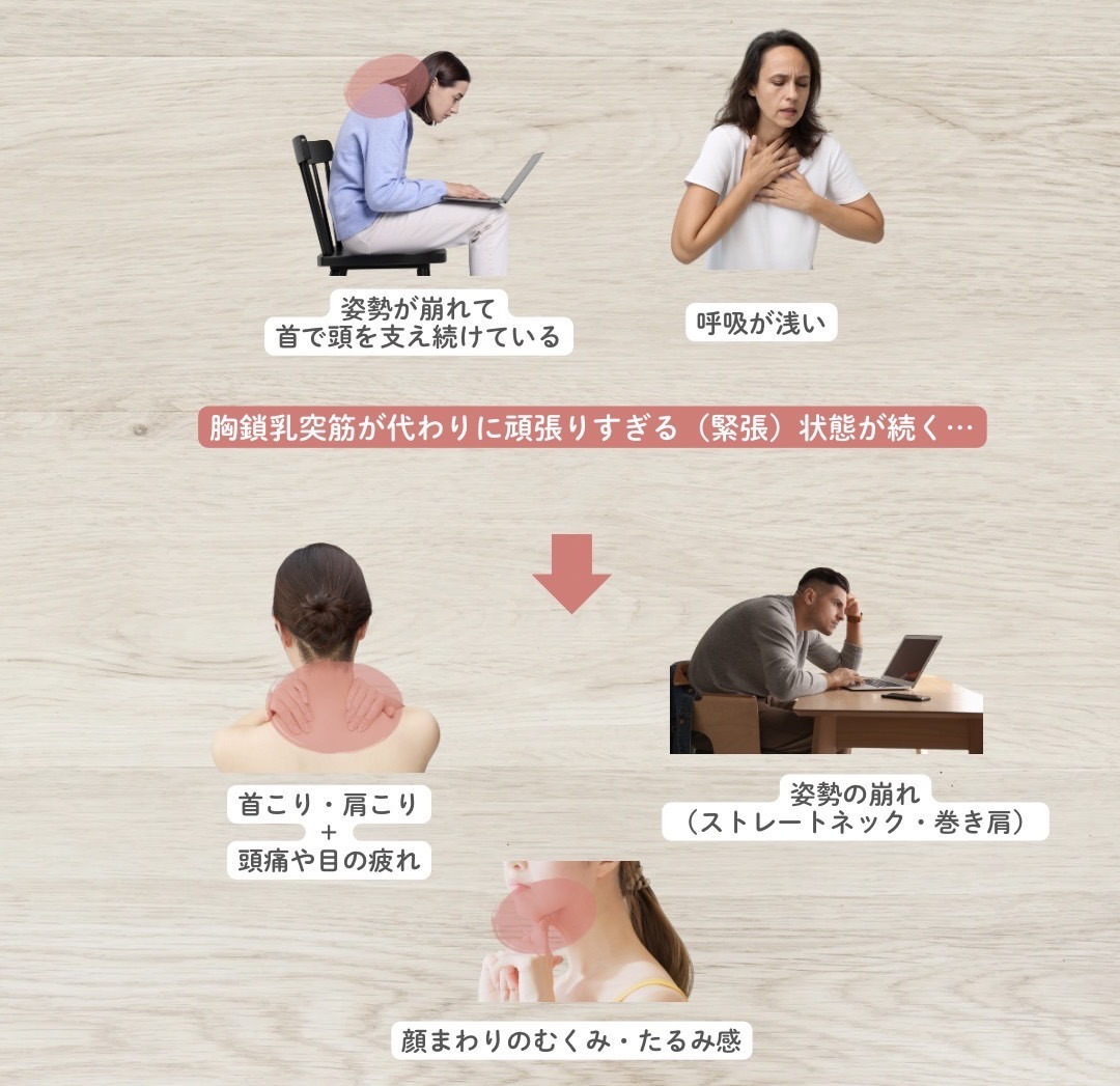 胸鎖乳突筋の過緊張による不調