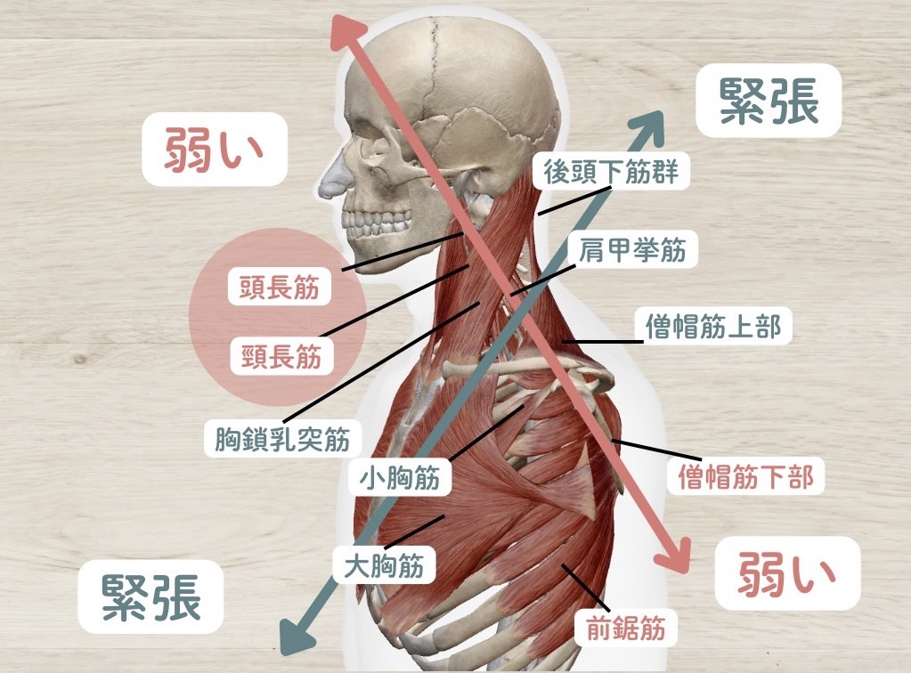 上位交差症候群