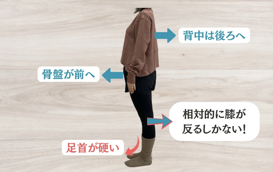 反張膝と姿勢バランス