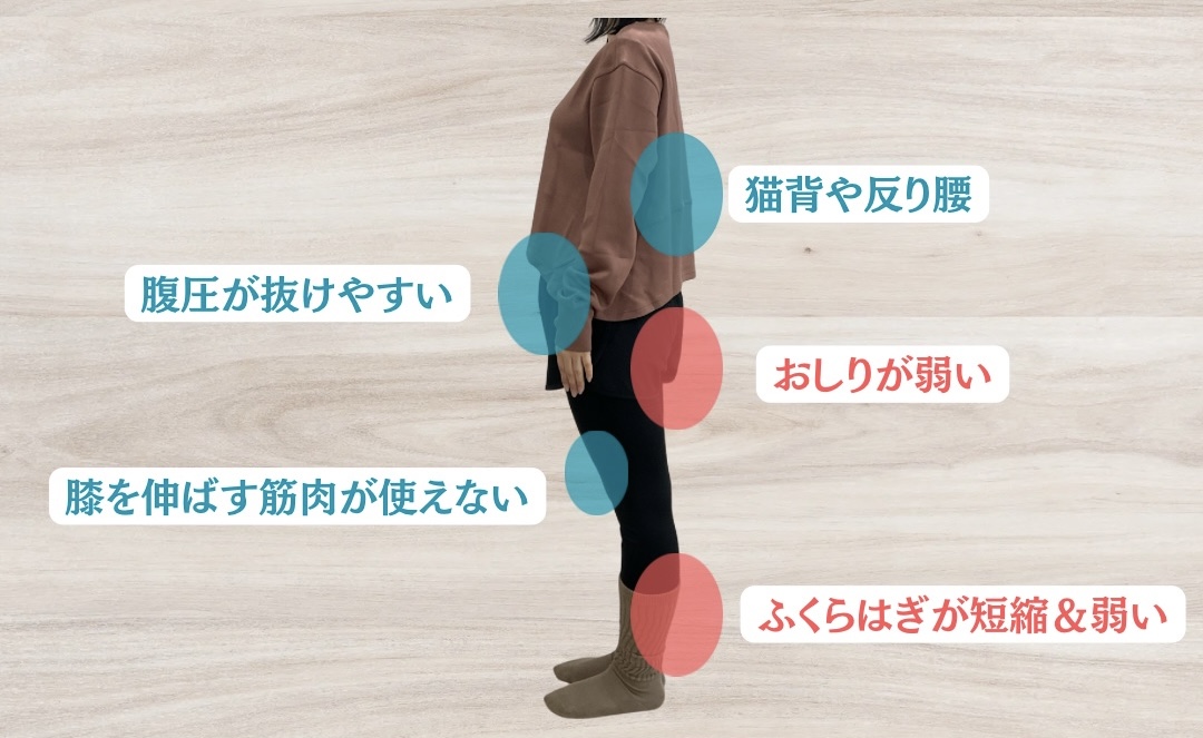 反張膝の筋肉バランス