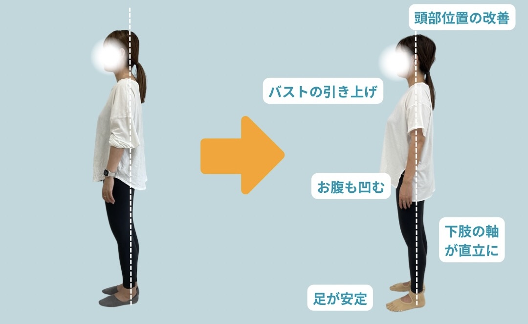 ビフォーアフター