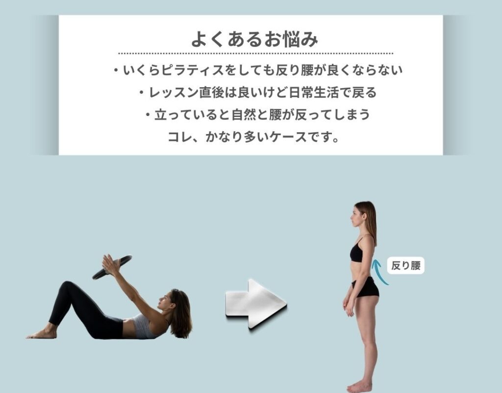 よくある反り腰のお悩み