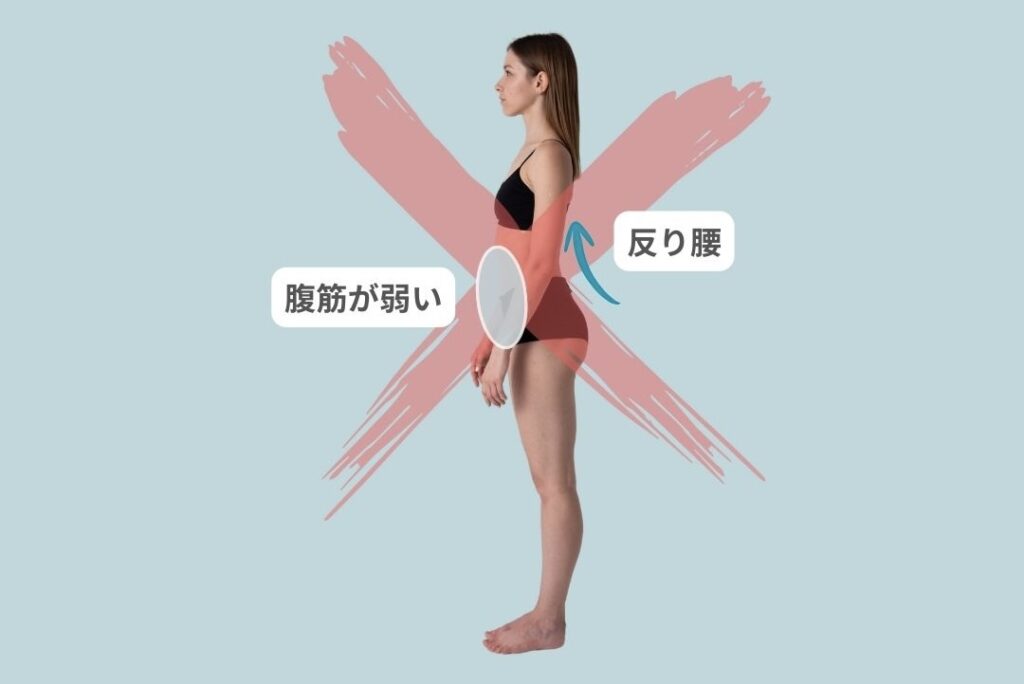 反り腰=腹筋が弱いはNG