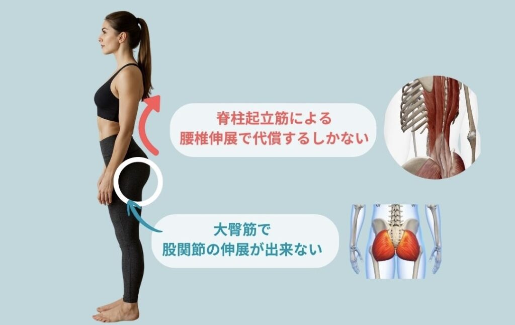 反り腰さんが苦手な動き=股関節の伸展