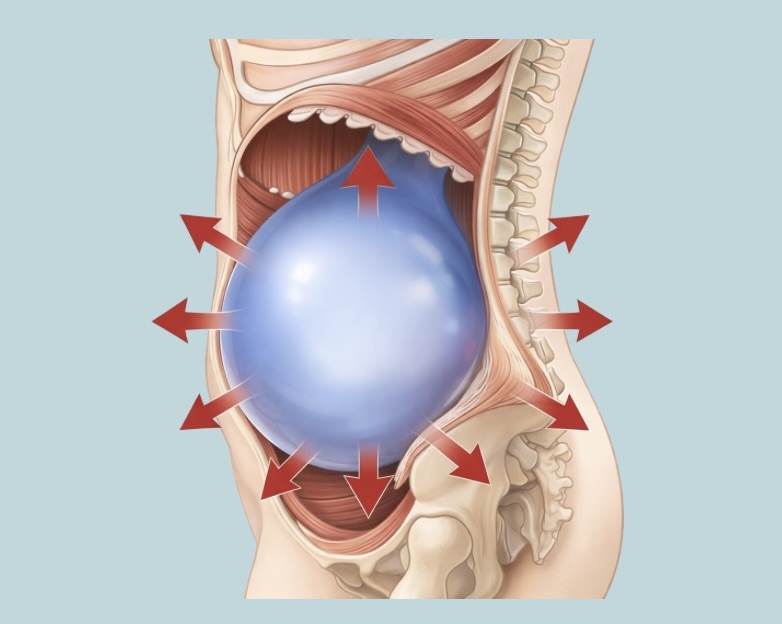 反り腰==腹圧が入らない