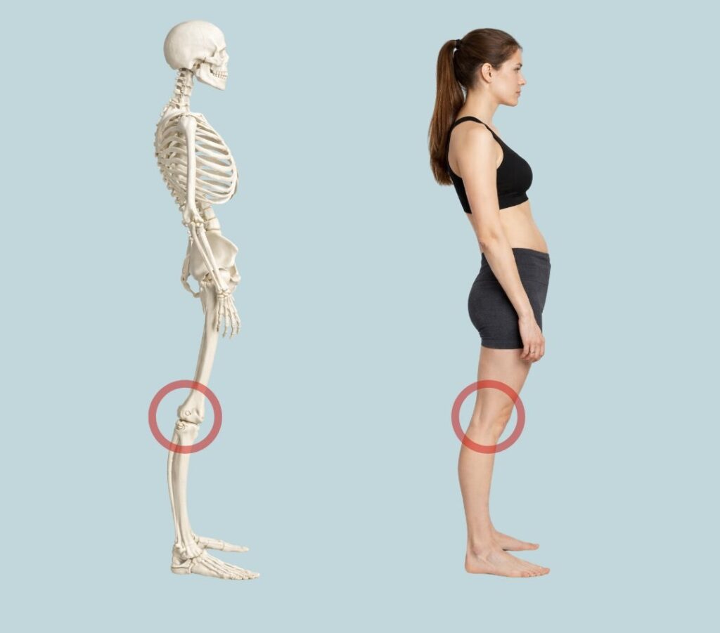 三島　ピラティス　反張膝