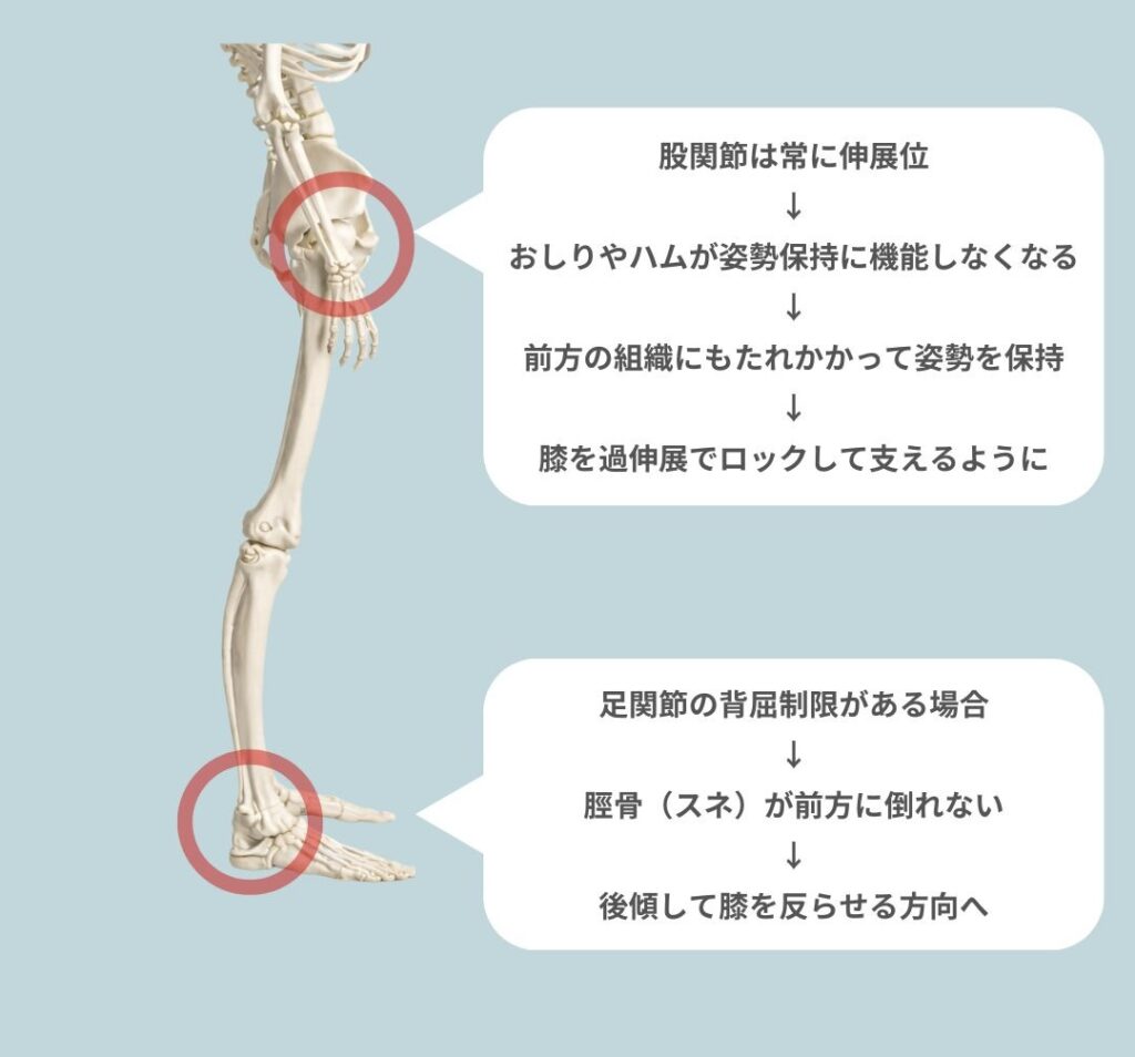 反張膝は膝の問題じゃない！？