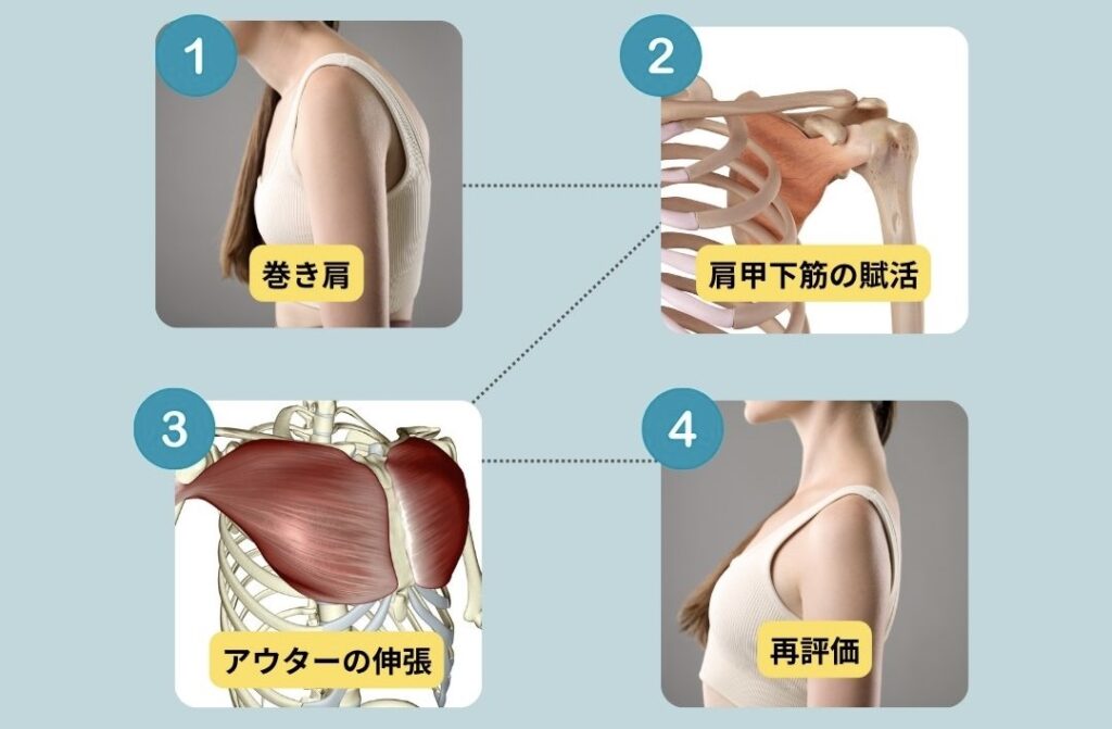巻き肩改善の正しいプロセスはこの4ステップ